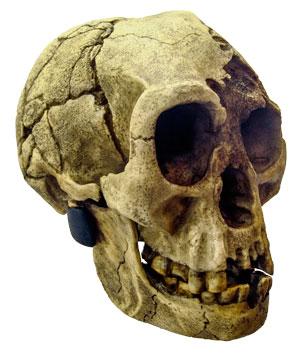 anatomist-hobbit-down-syndrome